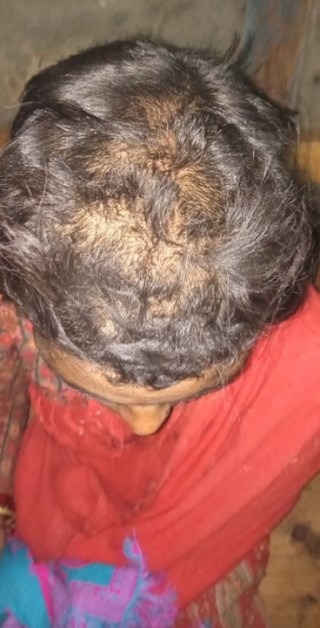 पर पुरुषसँग प्रेम सम्बन्धको आरोपमा  महिलालाई यातना