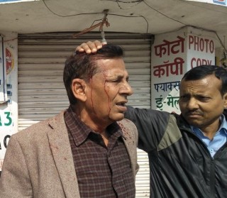 जनकपुरमा बन्द गर्दै हिडेका पूर्वमन्त्री झाको टाउकोमा प्रहरीले लाठी बजा¥यो
