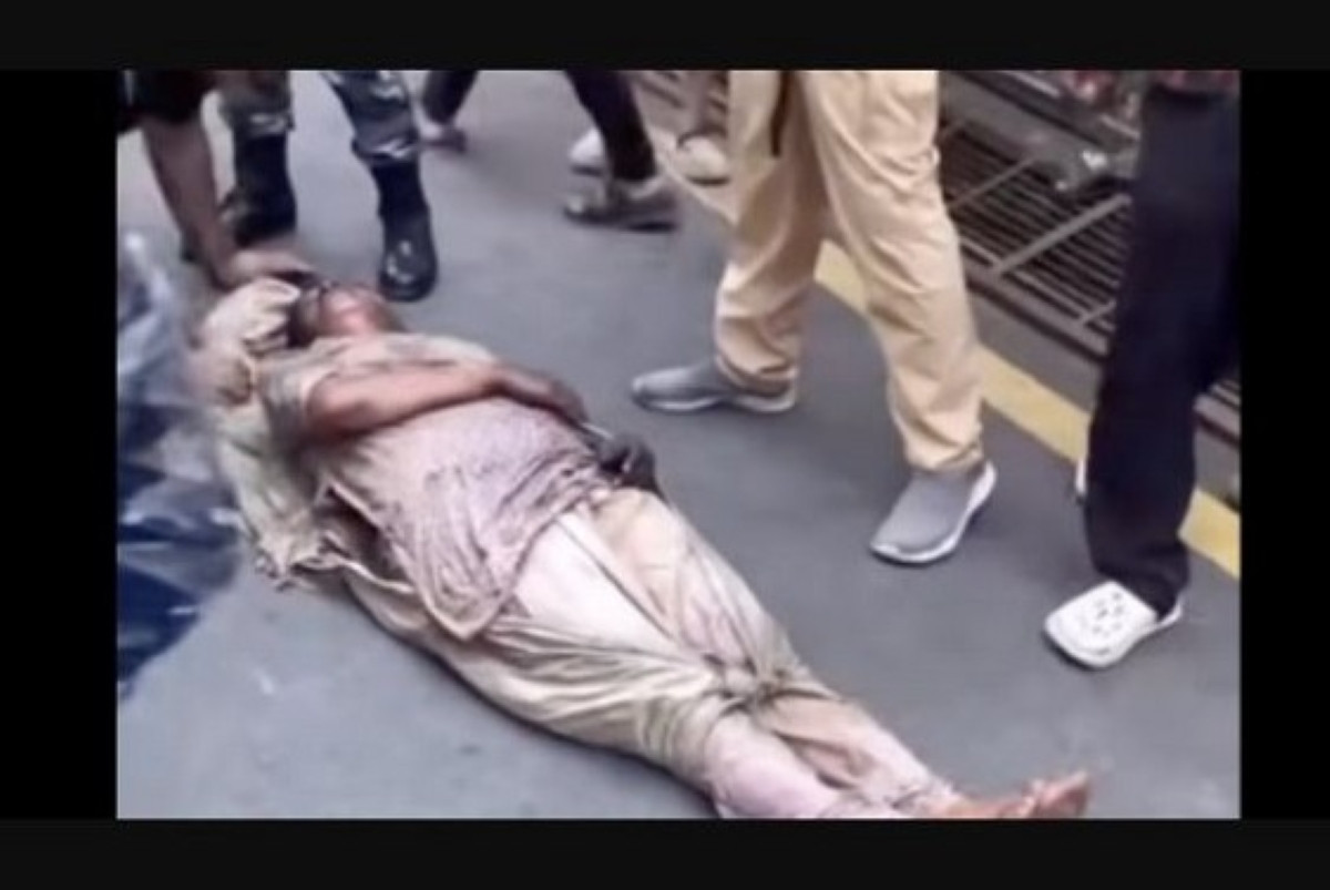 प्रदर्शनकारीले जिउदै जलाएका पूर्वप्रधानमन्त्री झलनाथ खनालकी धर्मपत्नी चित्रकारको स्वास्थ्यमा सुधार हुँदै
