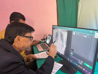 इच्छाकामनामा एआई एक्स रे द्वारा क्षयरोग खोज पड्ताल क्याम्प र नसर्ने रोग परिक्षण